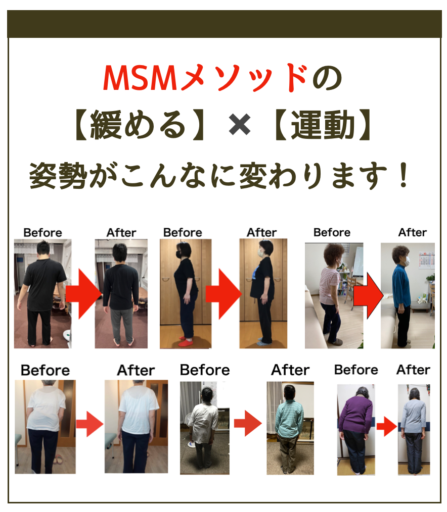 MSMメソッドによる姿勢のビフォーアフター6例